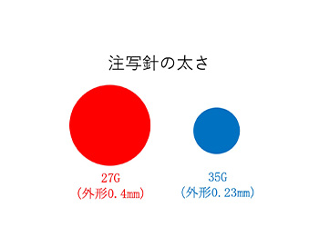 細い麻酔針の採用