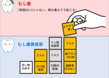 むし歯にならない方法。まずは原因を知ることから