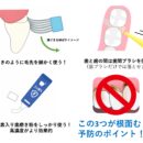 根面むし歯を防ぐセルフケアの“正しいやり方”