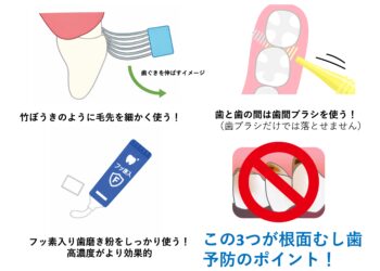根面むし歯を防ぐセルフケアの“正しいやり方”