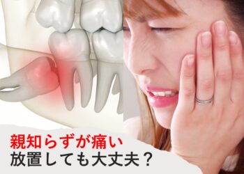 親知らずが痛い方へ　放置して大丈夫？歯医者に行くべき判断基準と対処法