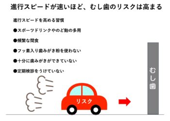 虫歯はスピードコントロールが大切