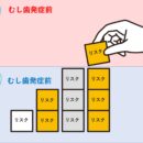 むし歯の原因はひとつじゃない!