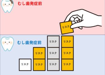 むし歯の原因はひとつじゃない！