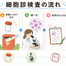 口腔がんは早期発見で変わる。"小さなサイン"を見逃さないために
