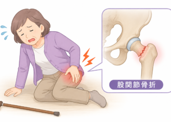 歯が少ないと骨折しやすい？高齢女性でわかった関係