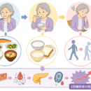 「“口の衰え”が糖尿病に影響する?」