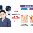 睡眠時間と歯周病の進行との関連について