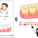 むし歯リスクが高まる『おやつとジュース』の組み合わせ