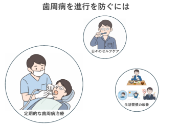 若くして歯周病になった人ほど、早期対応が重要です