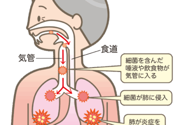 お口のケアで誤嚥性肺炎を予防しましょう～お口の健康が全身の健康を守ります～
