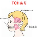 気づかないうちに歯を接触させていませんか?|TCH(上下歯列接触癖)がおこす口のトラブル