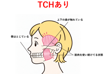 気づかないうちに歯を接触させていませんか？｜TCH（上下歯列接触癖）がおこす口のトラブル